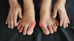 Heb je constant pijn in je teengewrichten? Experts leggen uit hoe je voorgoed van de pijn afkomt